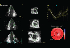 GE Vivid Club - 4D Strain White Paper