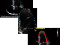 EchoPAC: How to work with the 2D Strain Analysis Package