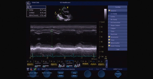 Vivid S6/S5: Basic System Operation - An introduction to ...