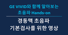 [Vivid와 함께 알아보는 Hands-on] 경동맥 초음파 기본검사를 위한 영상 시청하기 ...