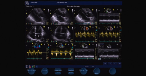 Vivid S6/S5: Basic System Operation - Review and End the examination 