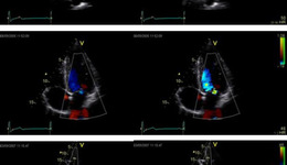 Imaging Settings