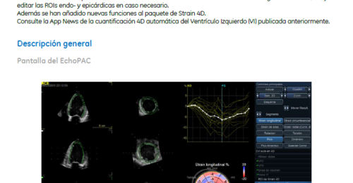 Vivid E95: Strain 4D Rotación y Torsión Ojos de buey dinámicos y  ...