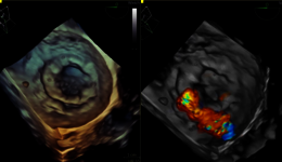 Hands-on-Training Strain & 3D