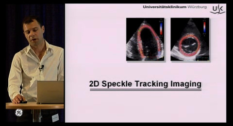 New insights in cardiac mechanics: Data acquisition and optimization ...