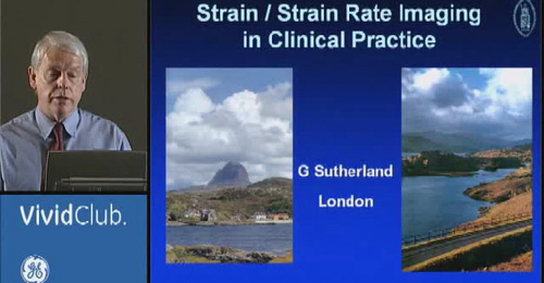 TVI, Strain & Myocardial Deformation Imaging: Doppler Myocardial ...