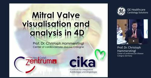 ESC 2019 - Mitral Valve visualisation and analysis in 4D ...