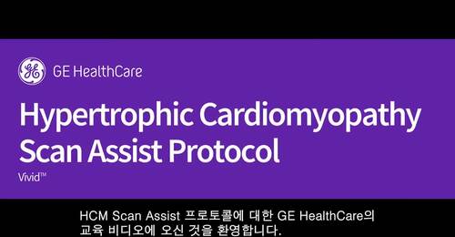 Hypertrophic cardiomyopathy Scan Assist Protocol 