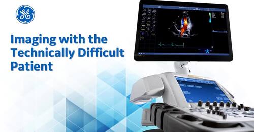 Cardiac image optimisation on your Vivid system