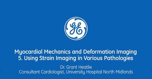  Using Strain Imaging in Various Pathologies