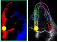 Standard waveforms in TTE - Velocity, Displacement, Strain ...