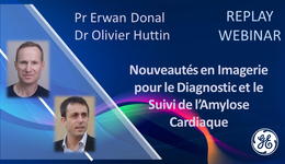 Nouveautés en imagerie pour le diagnostic et le suivi de  ...