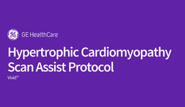 Hypertrophic cardiomyopathy Scan Assist Protocol 