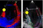 Vivid E9 / 7: Standard waveforms in TOE - Velocity, Displacement, ...