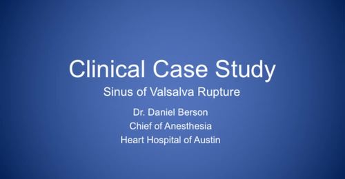 CVUS Tech Expo: Sinus of Valsalva Rupture with Dr. Daniel ...