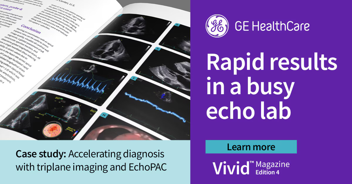 Rapid results in a busy echo lab