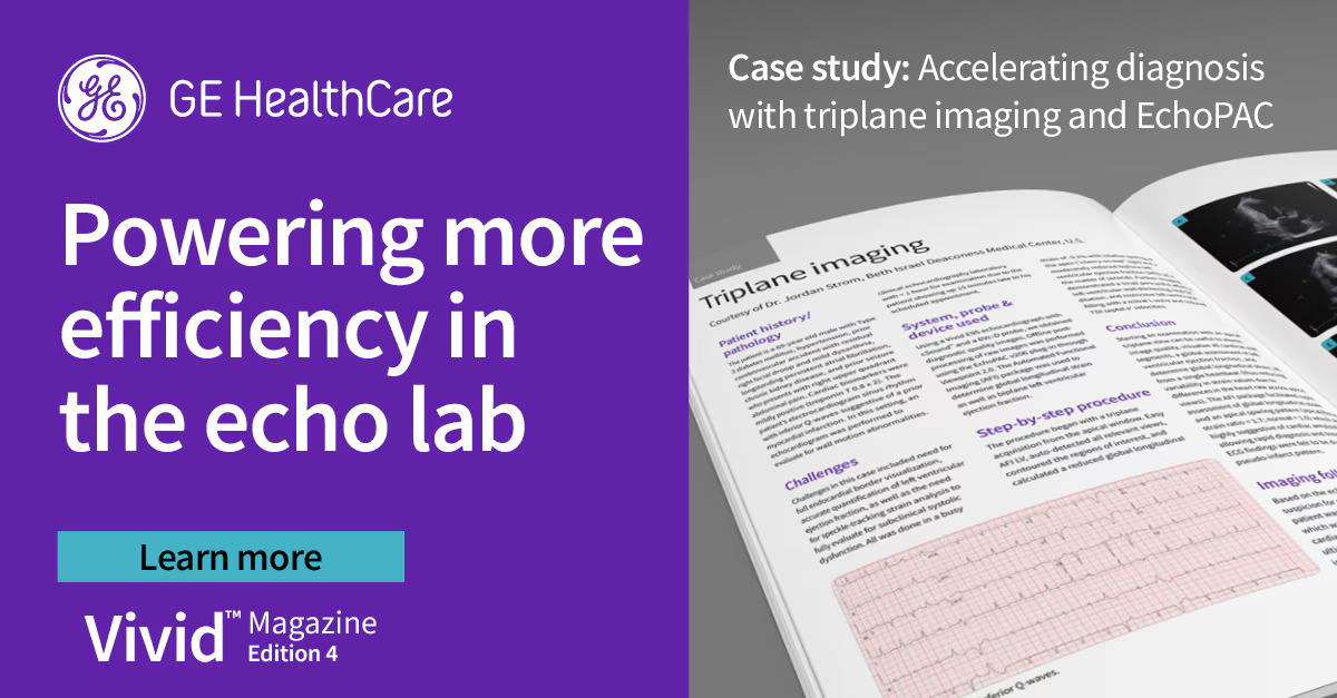 Powering more efficiency in the echo lab