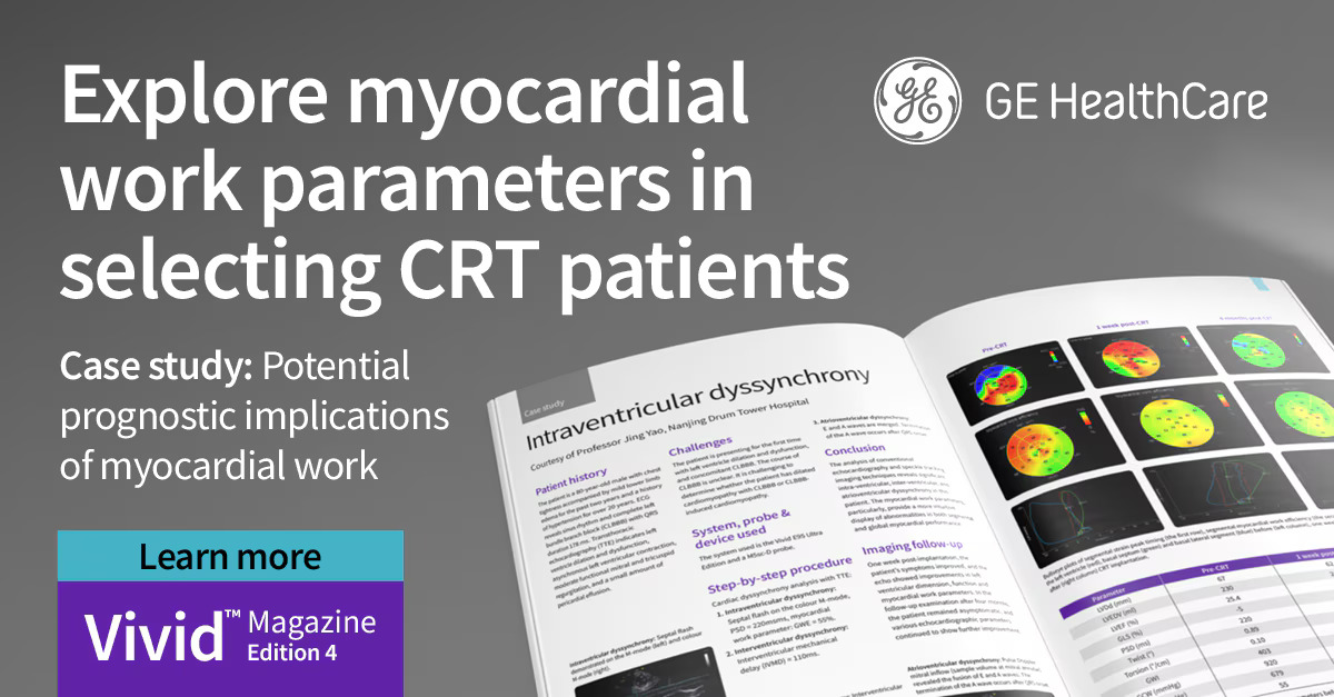 Exploring myocardial work parameters in selecting CRT patients