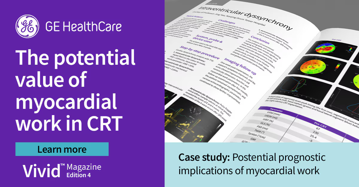 Case Study: Possible prognostic implications of myocardial work